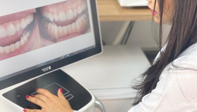 Aumenta a procura de procedimentos odontológicos estéticos após a flexibilização