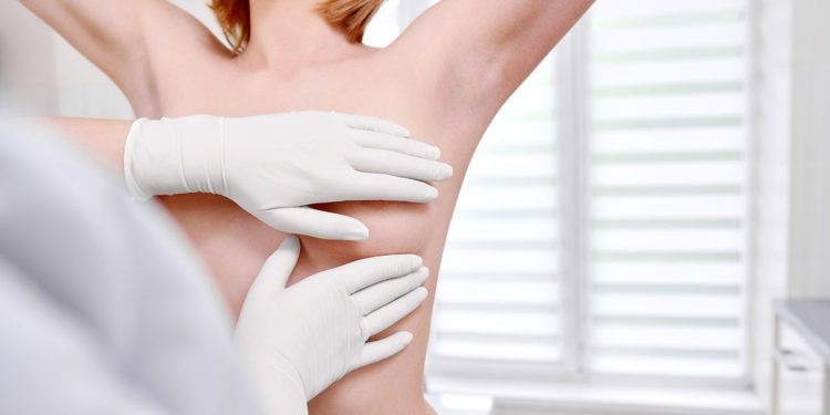 Autoexame da mama não substitui ida ao médico periodicamente