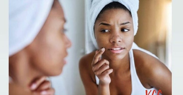 Os desafios de saúde e beleza da pele negra