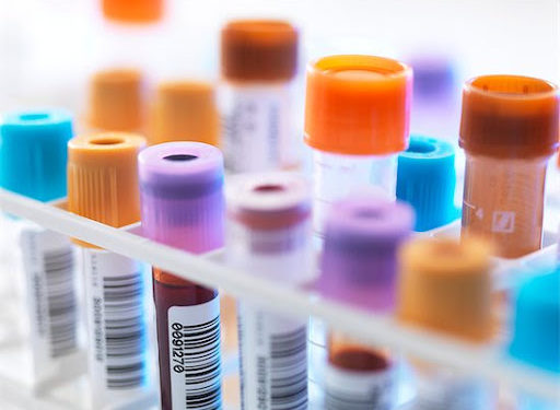 Brasileiros se acham com saúde boa ou muito boa