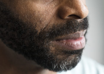 Como identificar os sinais do câncer bucal?