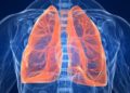 SUS amplia tratamento para doença pulmonar obstrutiva crônica