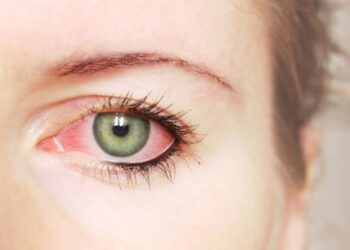 Os riscos à saúde ocular da população feminina