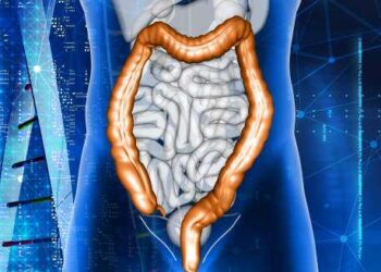 Março Azul: a importância da prevenção do Câncer Colorretal
