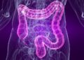 Maio Roxo alerta para doenças inflamatórias intestinais