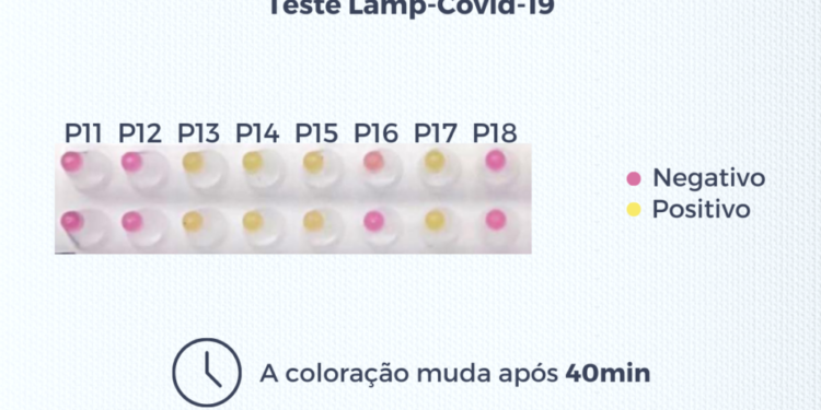 UFRJ desenvolve o Teste Lamp-COVID-19