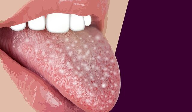 Covid-19: Boca pode ser a porta de entrada direta do sars-cov-2