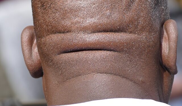 Mês de prevenção ao câncer de cabeça e pescoço