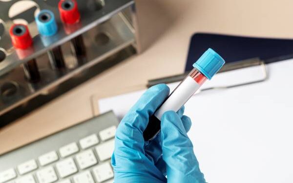 Exame de gravidez na demissão?