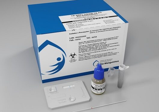 Covid: Fiocruz produzirá 60 milhões de testes de antígeno para o SUS