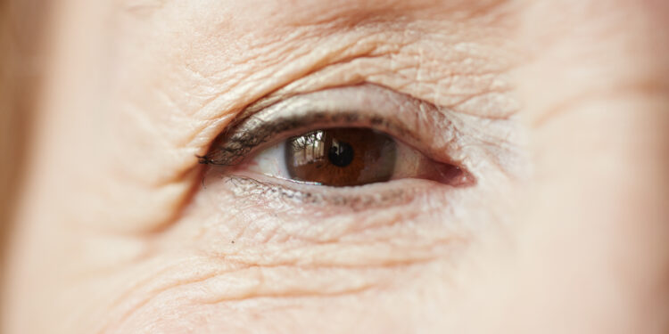 Rugas: cuidados com a própria imagem para além dos procedimentos estéticos