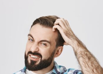 Caspa: sabe o que é, e como tratar?