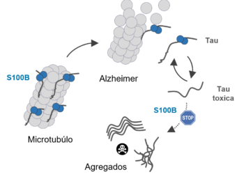 Proteína do cérebro pode atrasar o Alzheimer