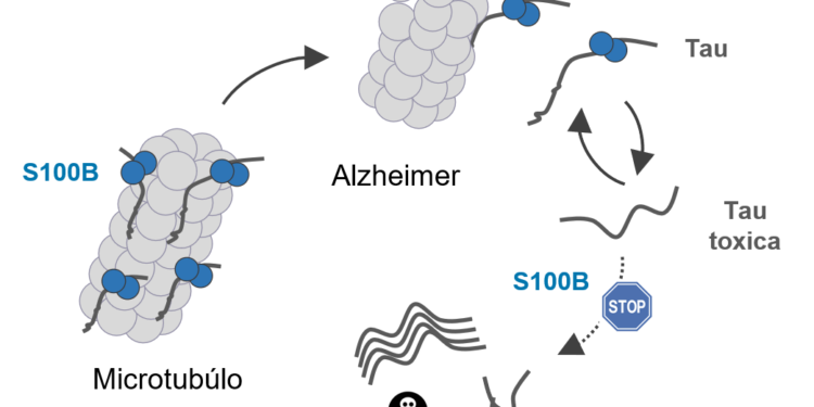 Proteína do cérebro pode atrasar o Alzheimer