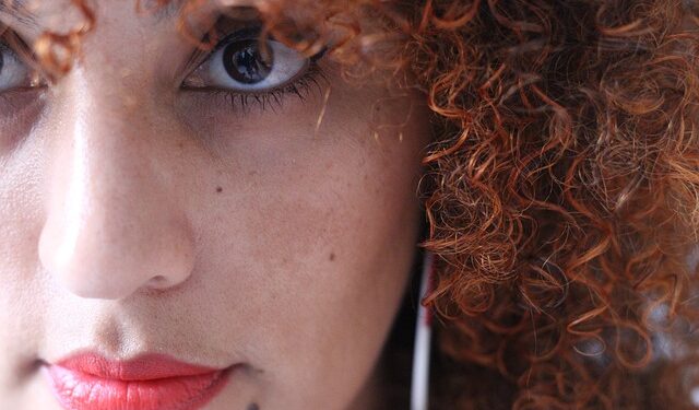 O melasma e os cuidados com a pele no verão