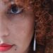 O melasma e os cuidados com a pele no verão
