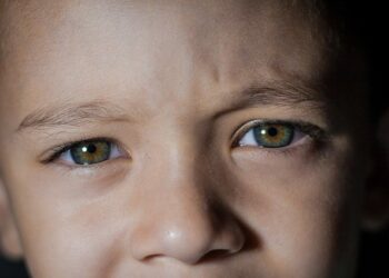 Retinoblastoma: entenda o que é a doença