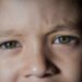 Retinoblastoma: entenda o que é a doença