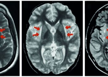 O cérebro e a forma como percebemos a dor