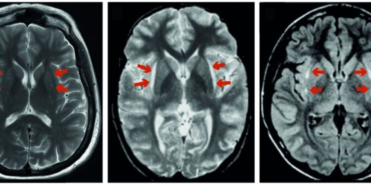 O cérebro e a forma como percebemos a dor