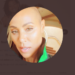 Entendendo a alopecia  e a queda de cabelo excessiva