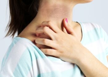 Acantose Nigricans: saiba o que é e como tratar