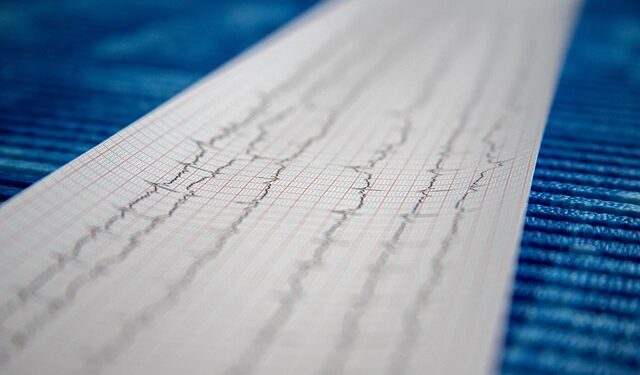 Arritmias cardíacas: qual técnica usar ?