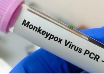 O que é a varíola dos macacos e o vírus monkeypox?