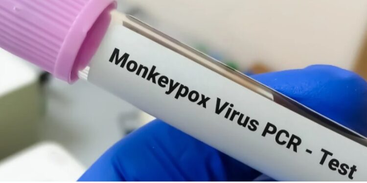 O que é a varíola dos macacos e o vírus monkeypox?