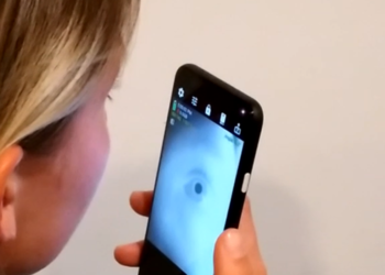 Diagnóstico de doenças neurológicas por aplicativo