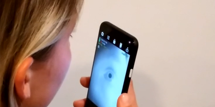 Diagnóstico de doenças neurológicas por aplicativo