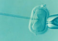 Endometriose afeta até 15% das mulheres em idade fértil