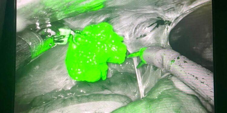 Tratamento do câncer e as tecnologias de última geração