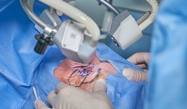 Estudo associa catarata e perda de visão precoce ao fumo