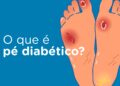 Pé Diabético e amputações não traumáticas