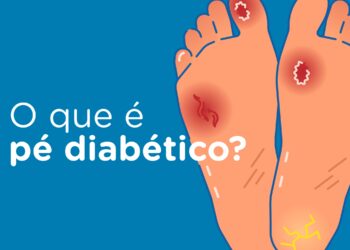 Pé Diabético e amputações não traumáticas