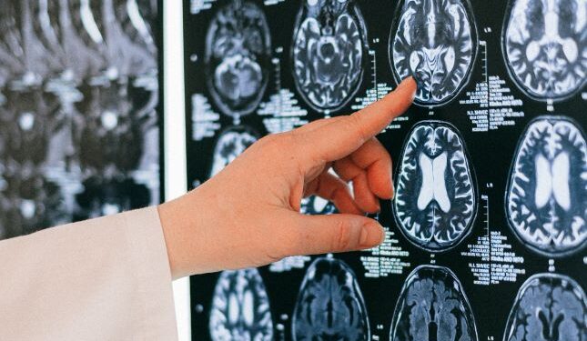 Histórico de diabetes e o risco de demência