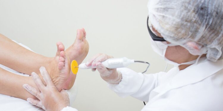 Saúde dos pés: por que ir ao podologista?