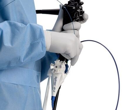 Técnica pode evitar até 65% de cirurgias em cânceres