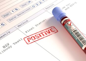 HIV/Aids: jovens perderam medo do vírus