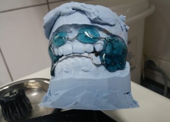 Conheça sete tipos de aparelho dentário