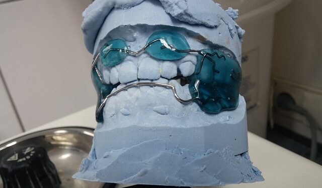 Conheça sete tipos de aparelho dentário