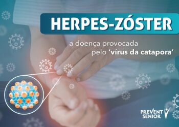 Os sinais da Herpes-Zóster no Adulto+