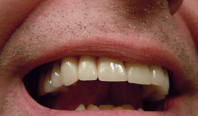 5 hábitos comuns a boca que prejudicam os dentes