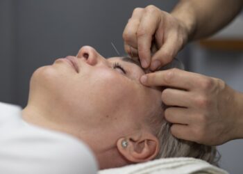 Os benefícios da Acupuntura na Odontologia