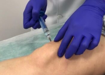 Ácido hialurônico na ortopedia