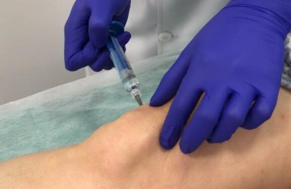 Ácido hialurônico na ortopedia