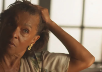 Tipos de alopecia e o transplante capilar