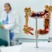 Teste revolucionário para o câncer de intestino