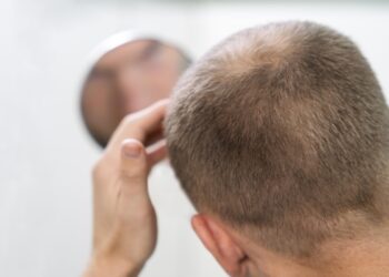 Óleo de abóbora no tratamento da calvície